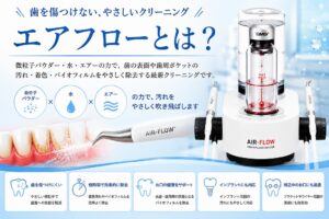 エアフローとは？歯の着色・茶渋を落とすクリーニングの効果とメリット