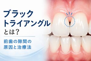 ブラックトライアングルとは？｜歯と歯の隙間が黒く見える原因と治療法
