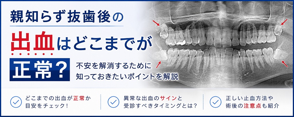 親知らず抜歯後の出血はどこまでが正常？