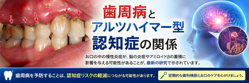 歯周病とアルツハイマー型認知症の関係