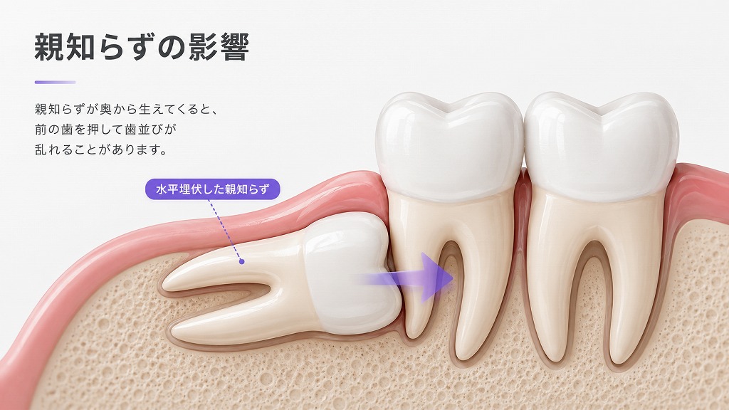 親知らずの影響