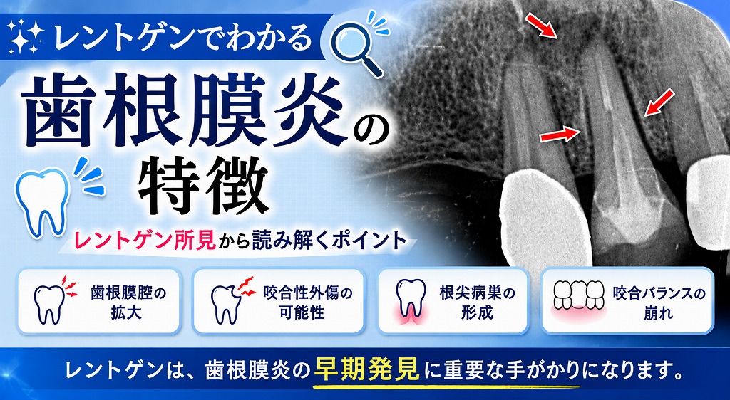 レントゲンでわかる歯根膜炎の特徴