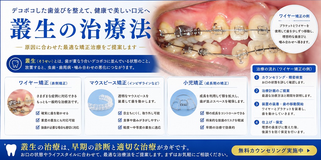 叢生の治療法