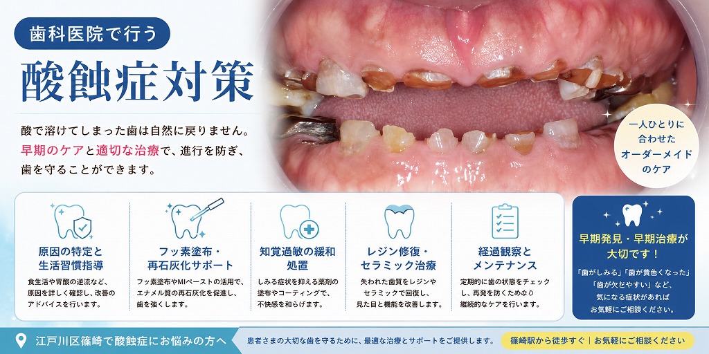 歯科医院で行う酸蝕症対策