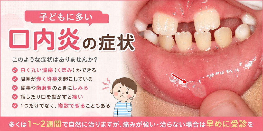 子供に多い口内炎の症状