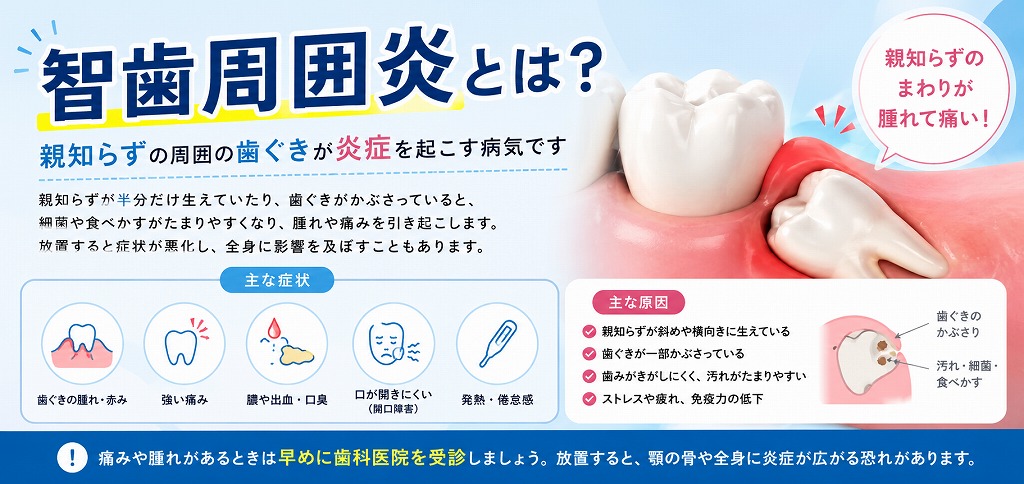 智歯周囲炎とは