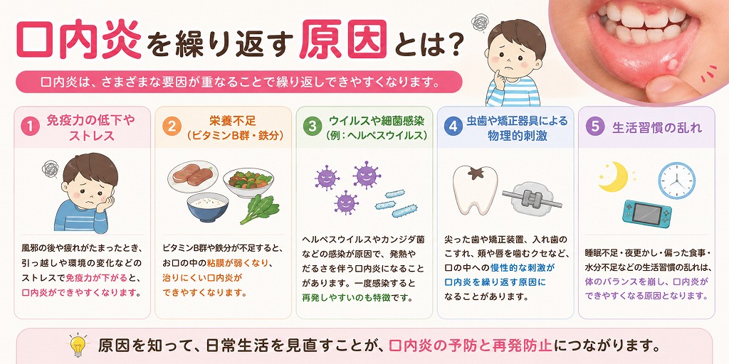 口内炎を繰り返す原因