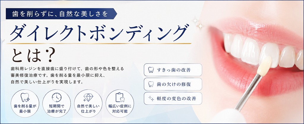 ダイレクトボンディングとは?