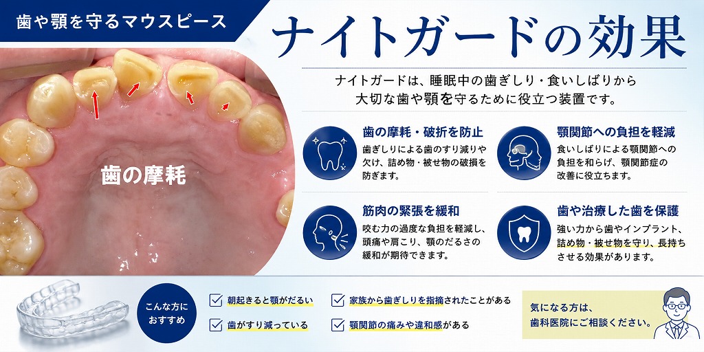 ナイトガードの効果