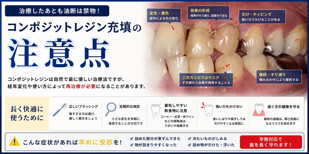 コンポジットレジン充填の注意点
