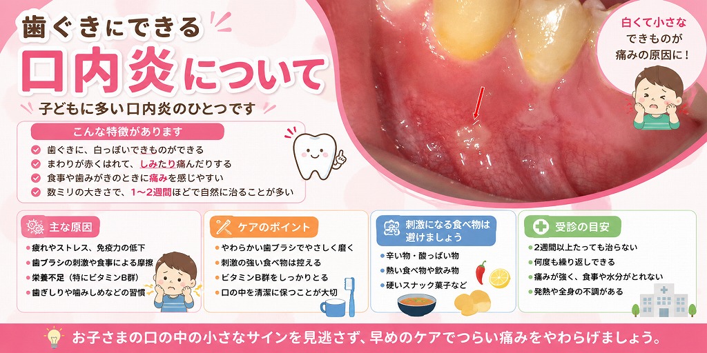 歯ぐきにできる口内炎について