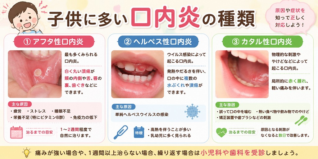 子供に多い口内炎の種類