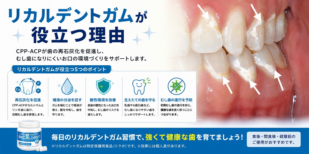 リカルデントガムが役立つ理由