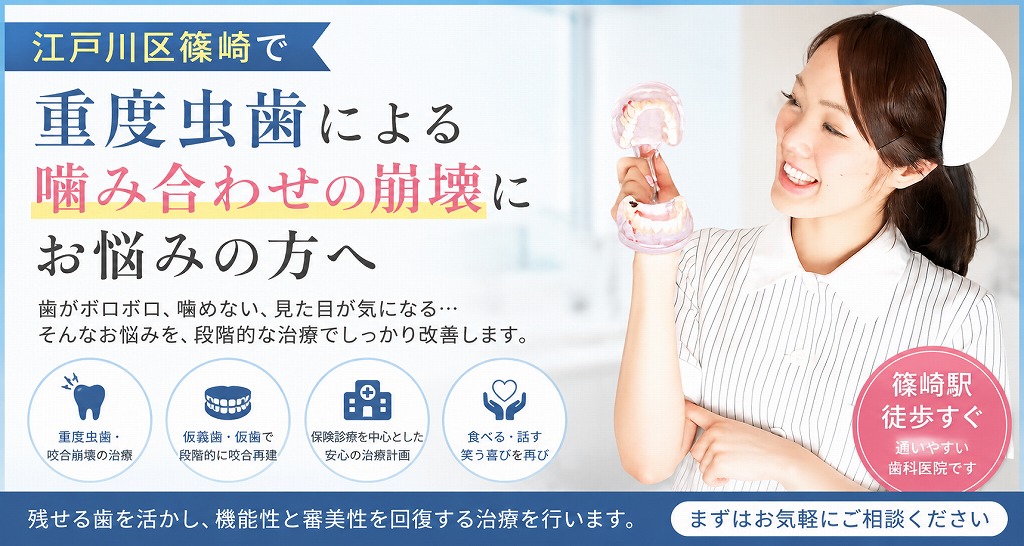 江戸川区篠崎で重度虫歯による噛み合わせの崩壊にお悩みの方へ