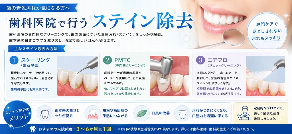歯科医院で行うステイン除去