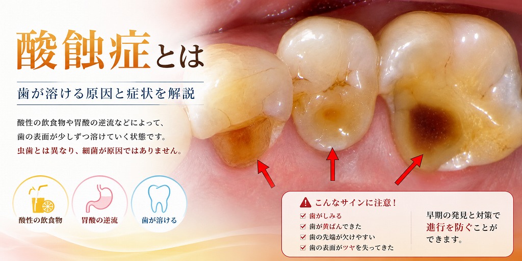酸蝕症とは