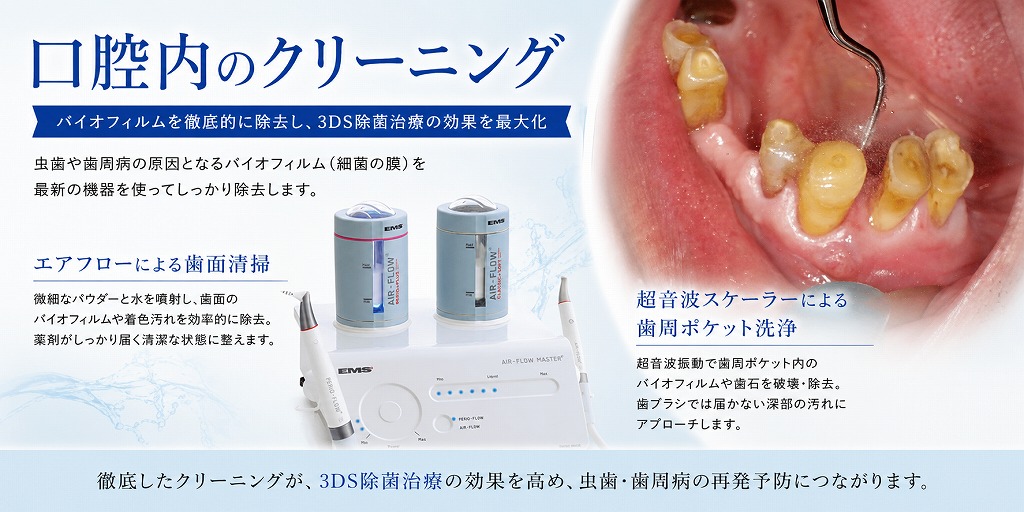 口腔内のクリーニング