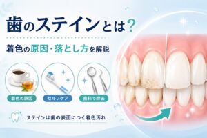 歯のステインとは？着色の原因・落とし方と歯科医院での除去方法