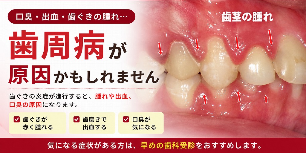 歯周病が口臭の原因かも