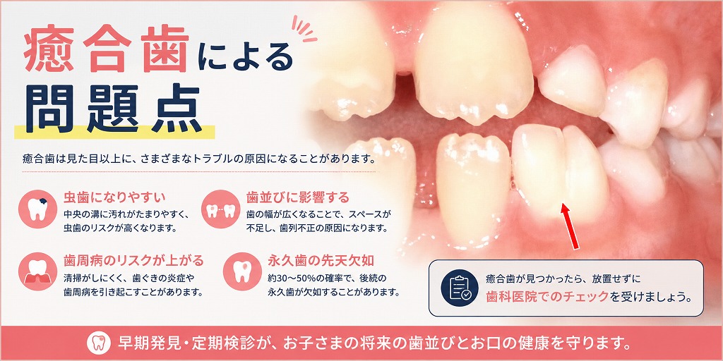 癒合歯による問題点