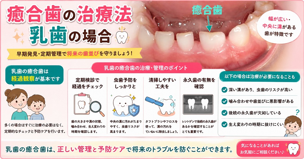癒合歯の治療法　乳歯の場合