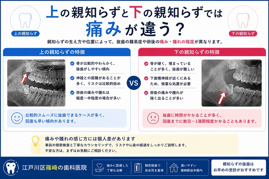 上の親知らずと下の親知らずでは痛みが違う？