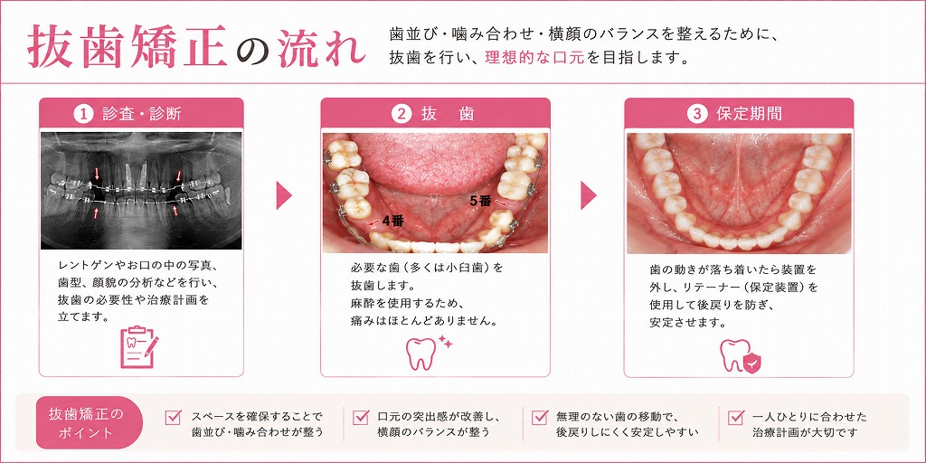 抜歯矯正の流れ