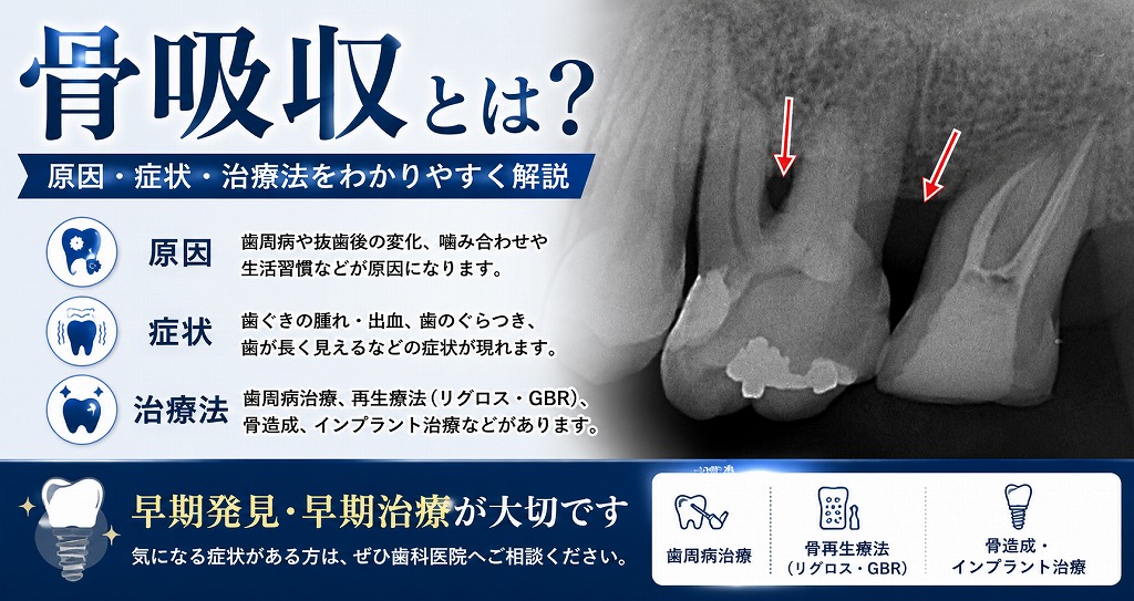 骨吸収とは