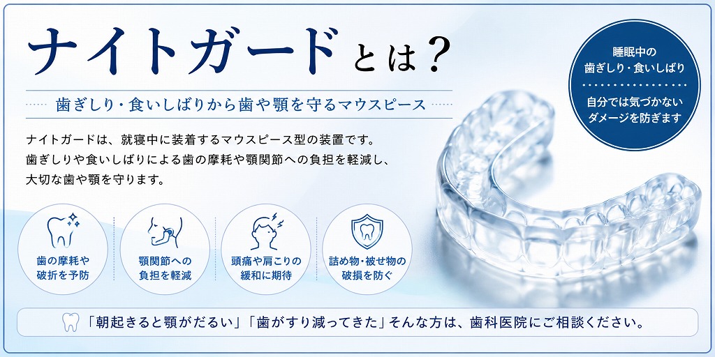 ナイトガードとは？