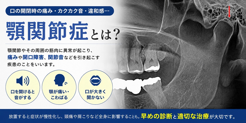 顎関節症とは
