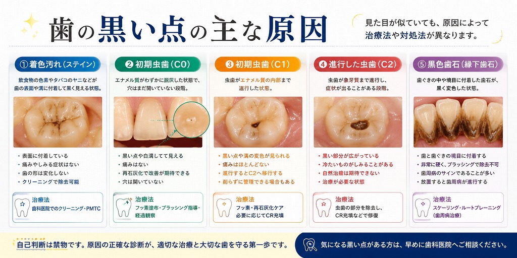 歯の黒い点の主な原因