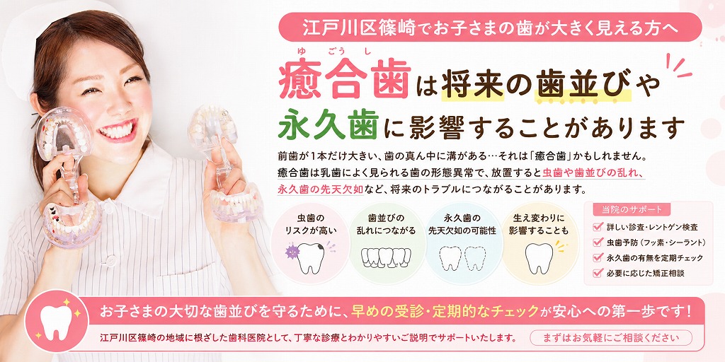 江戸川区篠崎でお子さまの歯が大きく見える方へ｜癒合歯は将来の歯並びや永久歯に影響することがあります