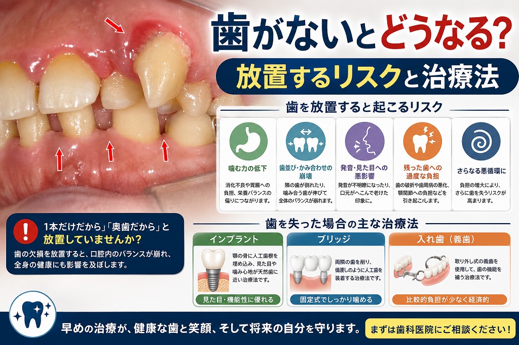 歯がないとどうなる？放置するリスクと治療法を歯科医師が解説