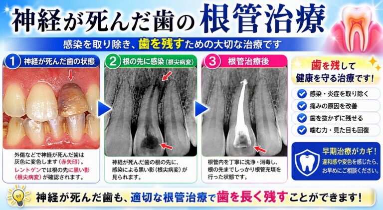 歯の神経を抜く治療とは?根管治療の流れ・痛み・注意点を歯科医師が解説
