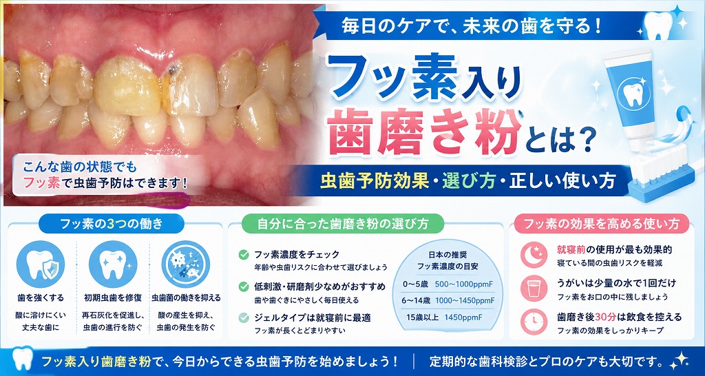 フッ素入り歯磨き粉とは？