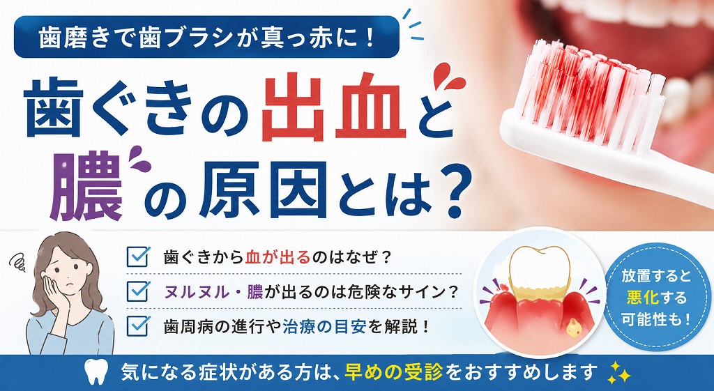 歯磨きで歯ブラシが真っ赤に！歯ぐきの出血と膿の原因とは？