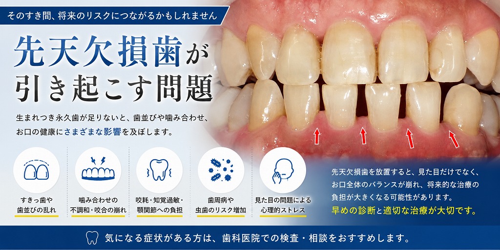 先天欠損歯が引き起こす問題