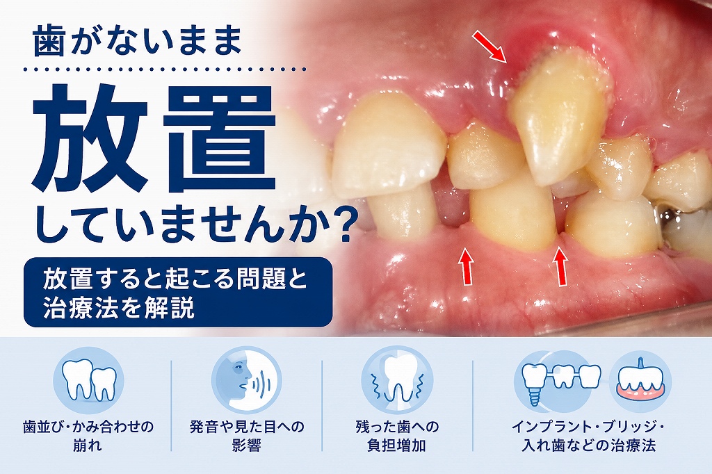 歯が1本ないまま放置するとどうなる？歯を失ったリスクと治療法を解説