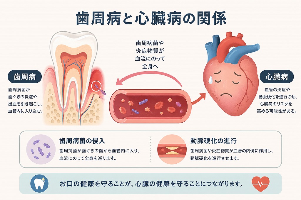 歯周病と心臓病