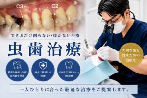虫歯治療