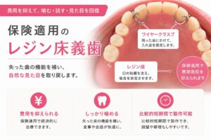 上顎前歯を失った症例｜保険の部分入れ歯（レジン床義歯）で治療