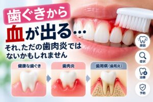 歯肉炎と歯周病の違いとは？症状・治療法・放置するリスク