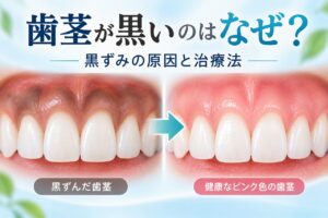 黒い歯茎とは？原因・治療・予防を解説｜ピンク色の健康な歯茎を取り戻す方法